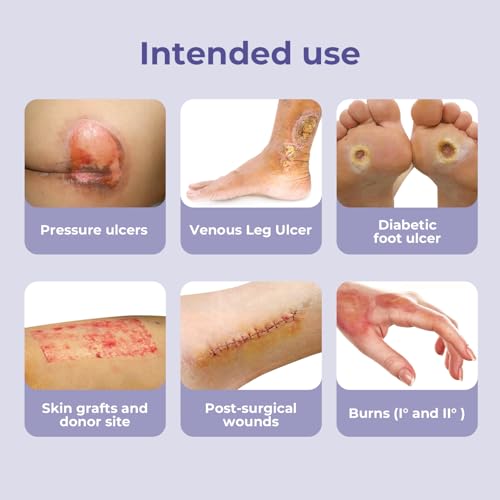 Conkote Silicone Foam Dressings with Border High Absorbency 4"x4", 10 Pack | Waterproof Wound Bandages for Pressure Ulcers, Diabetic Ulcers & Surgical Wounds - size: 4'' x 4''with border (10 Dressings)