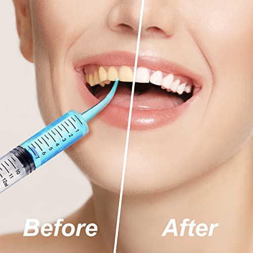 Zhengmy 100 Pcs Dental Syringe, Curved Tip, with Capacity Scale, 12ml - style: Curved Tip, with Capacity Scale