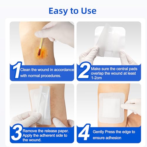 Niceful Island Dressing 6"x6" Bandages, 50Pcs Individually Wrapped - size: 6"x6"(50 Dressing)