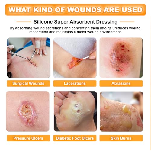 Carbou Silicone Super Absorbent Wound Dressing 5" x 5", 10 Individual Pack - size: 5"x5"