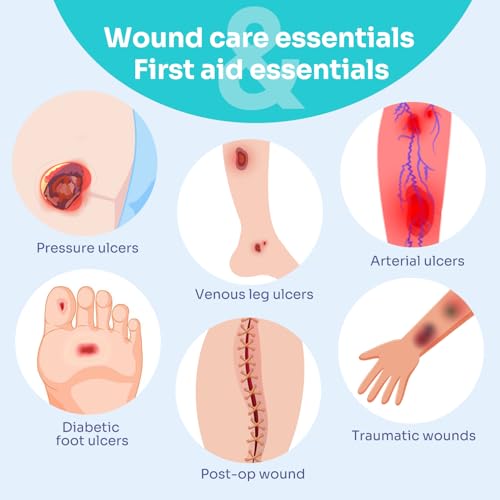 Conkote Super Absorbent Wound Dressing 4"x4" Non-Adhesive Pads, 10 Pack - size: 4" x 4" (10 Dressings)