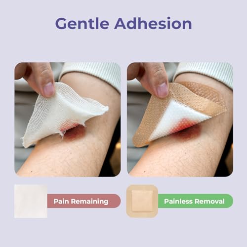 Conkote Silicone Foam Dressings with Border High Absorbency 4"x4", 10 Pack | Waterproof Wound Bandages for Pressure Ulcers, Diabetic Ulcers & Surgical Wounds - size: 4'' x 4''with border (10 Dressings)