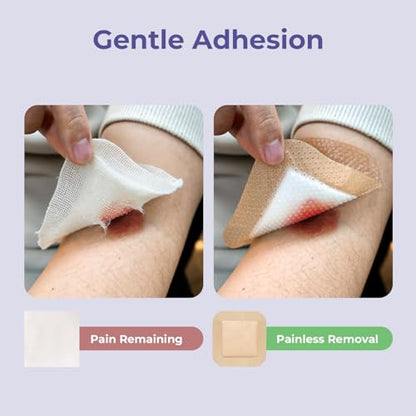 Conkote Silicone Foam Dressings with Border High Absorbency 4"x4", 10 Pack | Waterproof Wound Bandages for Pressure Ulcers, Diabetic Ulcers & Surgical Wounds - size: 4'' x 4''with border (10 Dressings)