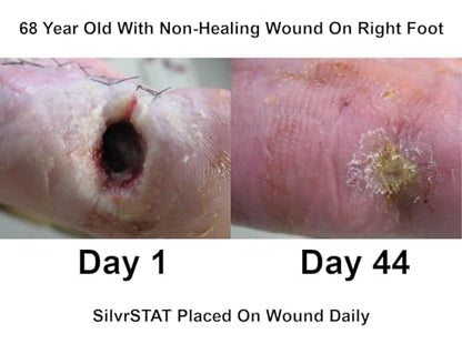 SilvrSTAT First Aid Kit Gel, 32 PPM Silver Healing Wound Dressing Solution, SilverSol Ag₄O₄ Particles, 3 oz - size: 3 Ounce