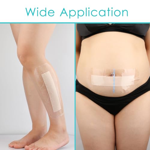 Silicone Knee Incision Bandages with Gentle Adhesive Wound Waterproof Dressing Absorbent Hip Water Barrier Shower Protector for Post Surgical Site Large Cuts Abrasions 4 x 10 Inch Pack of 5 - size: Waterproof 4"x10", style: Silicone(Pack of 5)