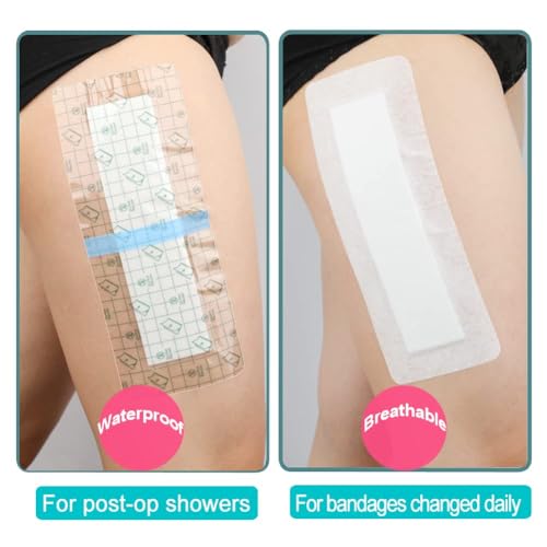 Waterproof Incision Bandages for Knee Replacement Knee Surgery Recovery Shower Cover Large Wound Shower Protector Adheisve Island Dressing Bandaid 4 x 6 Inch (Pack of 14) - size: Waterproof 4"x6", style: Pack of 14