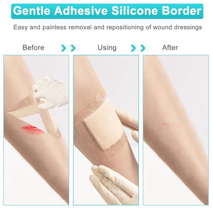 Silicone Foam Dressing 3"x3", Waterproof Absorbent Wound Dressing Bandages for Wound Care,10 Pack Wound Silicone Large Bandages - size: 3" x 3", 10 Pack
