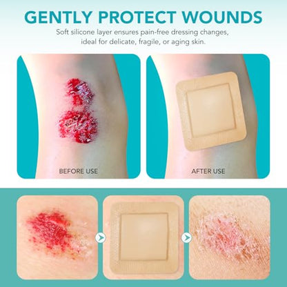 Silicone Foam Dressing Ag Sterile Wound Bandage with Waterproof Gentle Silicone Adhesive Border (5 Packs), 4"x 4" Breathable Ultra Absorbent Pads (4x4 Inch (Pack of 5)) - size: 4x4 Inch (Pack of 5)