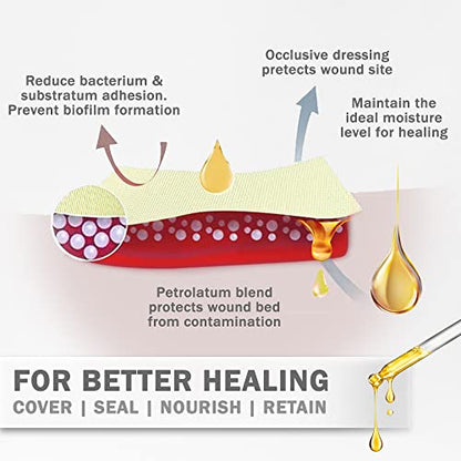 EVERLIT Xeroform Petrolatum Dressing | Sterile, Non-Adherent Occlusive Fine Mesh Gauze Pad | Non-Toxic, Gentle Patch for Burns, Laceration, Surgical Incisions & Skin Grafts (2" x 2" | Pack of 25) - size: 2" x 2" | Pack of 25