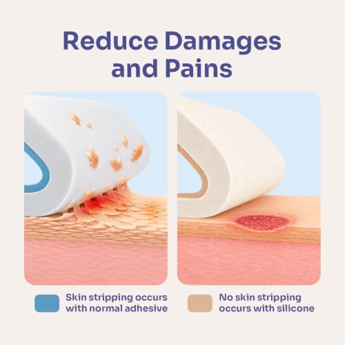 Conkote Silicone Foam Dressing Highly Absorbent 4"x4", 10 Pack | Wound Care Bandagefor Post-Operative, Pressure Ulcers, Diabetic Foot Ulcers, Venous Leg Ulcers - size: 4'' x 4''Adhesive (10 Dressings)