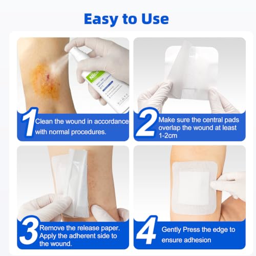 Niceful Bordered Gauze Island Dressing 4"x10", 25Pcs - size: 4"x10"(25 Pcs)