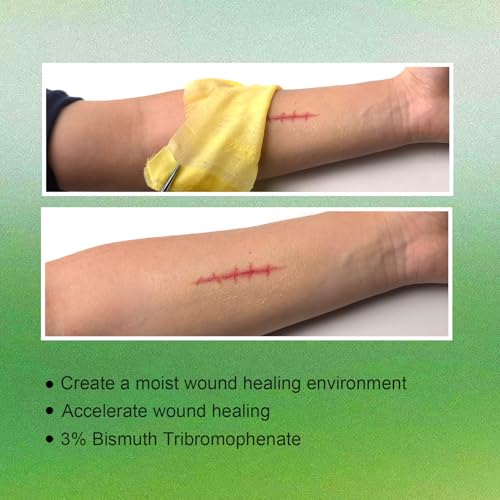 Non-Adherent Xeroform Petrolatum Dressing 5"x9", 25 Individual Pack, Soft Fine Mesh Gauze Patch for Wound Care, Burns, Lacerations, Skin Grafts & Surgical Incisions