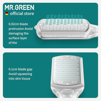 MR.GREEN Pedicure Tools Foot File Heels Rasps Callus Remover for Foot Scraper with Storage Box Stainless Steel File