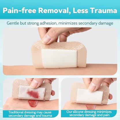 20 Pack Silicone Foam Dressing 4"x4" Gentle Border, Waterproof Silicone Bandages for Wounds Care, Super Absorbent Wound Dressing, Bed Sore Patches, Self Adhesive Pressure Sore Pads