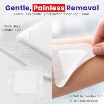 HEALQU Island Dressing - 4"x4", 30 Count - Bordered Gauze Sterile Individually Wrapped Gauze Pads, Water-Resistant, Non-Woven Backing - Soft and Breathable Wound Dressing for First Aid and Medical | Water-Resistant, Latex-Free, High Absorbent, Adhesive Bo