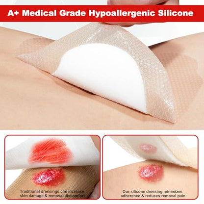 FRESINIDER 7"x7" (Pack of 5) Wound Silicone Sacral Foam Dressing - Sacrum Foam Adhesive with Border - Waterproof Absorbent Breathable Bed Sore Pressure Pads - color: 7" X 7" , 5 Pack