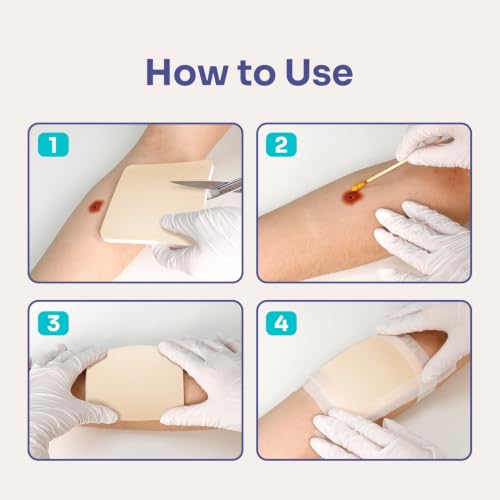 Conkote Foam Dressings Non-Adhesive Pads for Exudating Wounds 4"x4" 10 Pack | Highly Absorbent Waterproof Dressing for Wound Care, Ulcers, Post Op Trauma, Injuries, Burn - size: 4'' x 4''Non-Adhesive (10 Dressings)