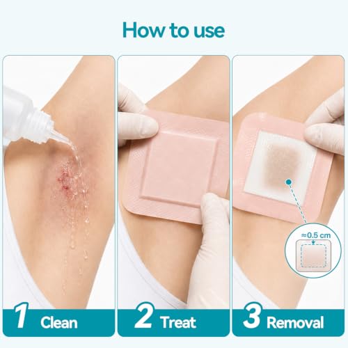 Dimora Silicone Foam Dressing 4"x4" Hidradenitis Suppurativa Pads - size: 4" x 4" (10 PCS)
