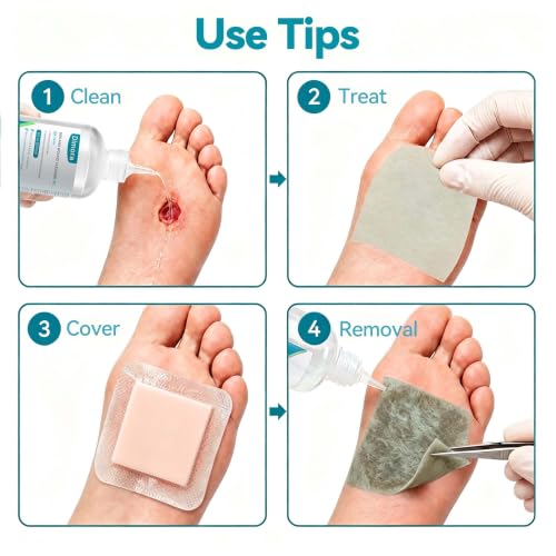 Dimora Upgrade Silver Calcium Alginate Wound Dressing -Silver-Infused Wound Care Non Stick Gauze for Wounds Care, Highly Absorbent Sterile Bandage Pads with Ag, 2'' x 2'' Patches 12 Packs Individual - size: 2'' x 2'', style: Upgrade Ag alginate 12pack(2''