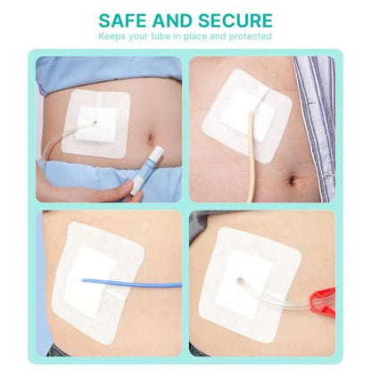 Split Drain Adhesive Bandages 4" x 4" Pre-Cut for Feeding Tubes, Dialysis Catheters & Drains - Soft Non-Stick Pad - Individually Wrapped 20 Pack Wound Dressing Pads