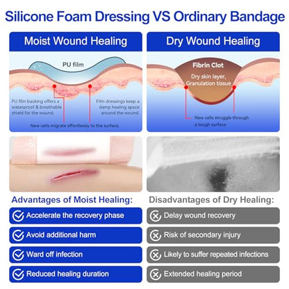 Niceful Silicone Foam Dressing 4"x4" 10 PCS Waterproof Bandages for Wound | Self-Adhesive Bordered Silicone Foam, 5-Layer Exudate Lock, Waterproof Painless Peel, Pressure Sores & Surgery, Sealed - size: 4"x4"(10 PCS)