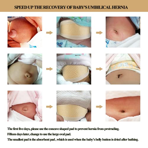 Umbilical Hernia Belt Baby Belly Button Band Infant Belly Wrap Truss Abdominal Binder for Children Kids Support Adjustable Navel Belly Band Newborn Umbilical Cord 15-20 inch