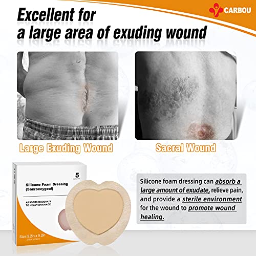 Carbou Silicone Sacrum Foam Dressing, 9"x9"(23cmx23cm), Box of 5 | Bordered Adhesive Sacral Foam Dressing, Soft Bed Sore Bandages, Wound Care Products, Dressings - size: 9x9 Inch (Pack of 5)