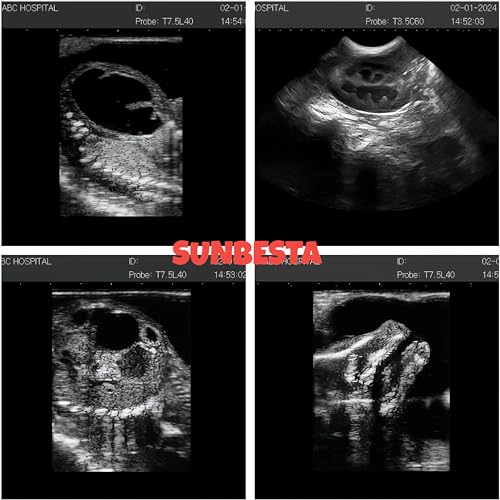 N50 Portable Veterinary Ultrasound Machine for Animal Pregnancy - size: Convex Probe