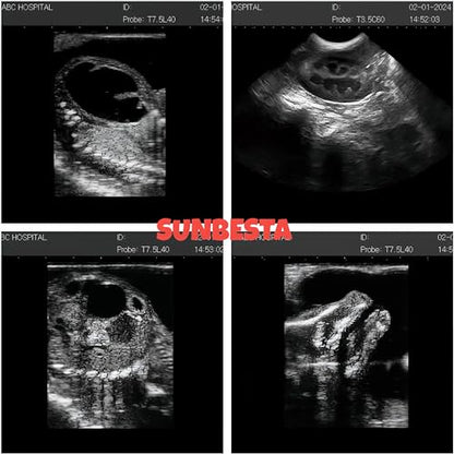 N50 Portable Veterinary Ultrasound Machine for Animal Pregnancy - size: Convex Probe