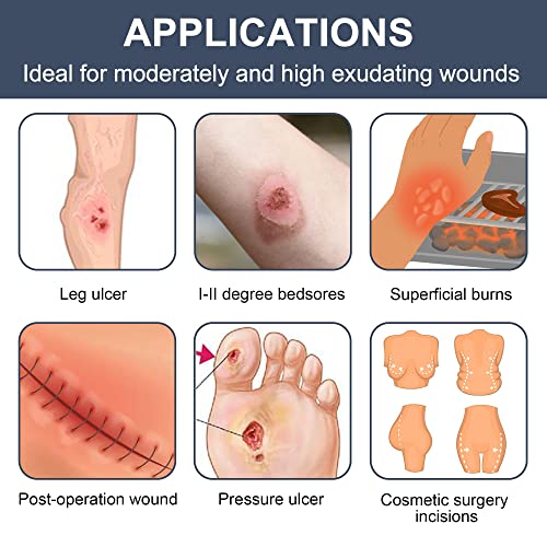 LotFancy Calcium Alginate Wound Dressing, 4"x 4" Non-Stick Pads for Wounds - style: 4"x 4" (10-Count)