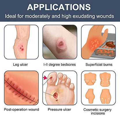 LotFancy Calcium Alginate Wound Dressing, 4"x 4" Non-Stick Pads for Wounds - style: 4"x 4" (10-Count)