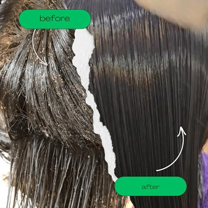 My Hair Helpers Lice Eliminator Comb, For 1-2 Kids - size: 1
