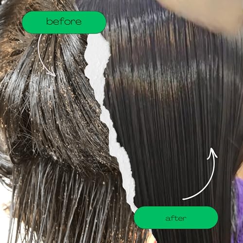 My Hair Helpers Lice Eliminator Comb - Stainless Steel - Effectively Removes Louse, Nits and Superlice from Hair - For 2-3 Kids - size: 2 combs