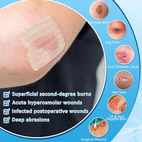 Geiserailie Hydrogel Wound Dressing 20 Pack