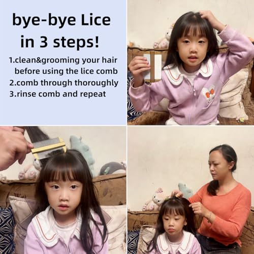 Vivifivenca Durable Lice Comb Stainless Steel Asian Large size 4inch Double - Sided Ultra Fine Tooth (Nits/Eggs), Dense Tooth (Flea/Ticks/Dandruff), Safe for Humans & Pets Scalp (Gold）