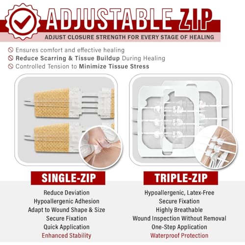 EVERLIT CARE Wound Closure Kit | 28 Pcs All-in-One First Aid with Suture-Free, Stitchless Zip Devices, Butterfly Bandages, for up to 6" Wounds | 100% Sterile Medical Supplies to Clean, Cover & Heal