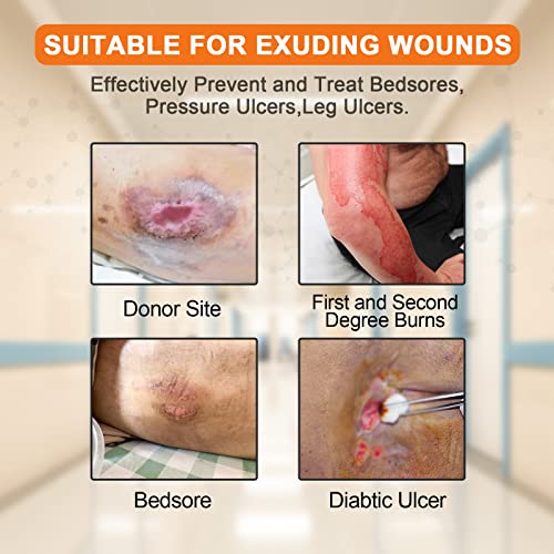 Carbou Silicone Foam Dressing with Gentle Border,4"x4" Adhesive Waterproof and High Absorbency Square Wound Care Dressing Bandage for Pressure Sore, Leg Ulcer, Diabetic Ulcer,10 Pack - size: 4x4 Inch (Pack of 10)