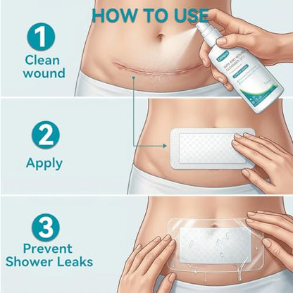 Dimora Silicone Foam Dressing Ag Silver Wound Care 4 x10 - size: 4”x10" Ag(5 PCS)