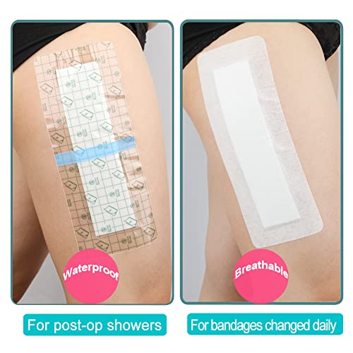 Waterproof Incision Bandages for Large Wounds Knee Hip Replacement Adheisve Island Dressing Bandaid Tape Post Surgical Shower Protector, No Glue On Center 4 x 10 Inch (Pack of 14) - size: Waterproof 4"x10", style: Pack of 14