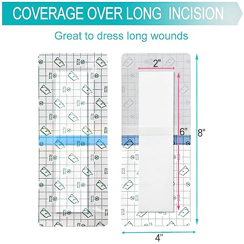 Waterproof Incision Bandages for Large Wounds Knee Hip Replacement Adheisve Island Dressing Bandaid Tape Post Surgical Shower Protector, No Glue On Center 4 x 8 Inch (Pack of 14) - size: Waterproof 4"x8", style: Pack of 14