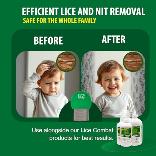Lice Combs| Head Lice Professional Metal Set of 2 for Long & Short Hair | Efficient Lice and Nit Removal | Easy to Use. FREE MAGNIFYING GLASS INCLUDED