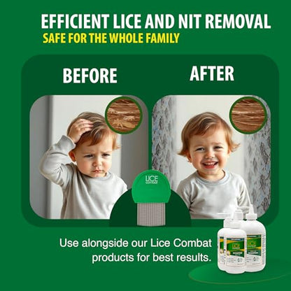 Lice Combs| Head Lice Professional Metal Set of 2 for Long & Short Hair | Efficient Lice and Nit Removal | Easy to Use. FREE MAGNIFYING GLASS INCLUDED