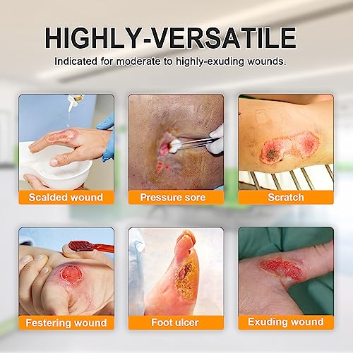 Carbou Silver Calcium Alginate Wound Dressing with Ag, 4"x4" Pads, 5 Pcses - size: Silver 4x4 In(Pack of 5)
