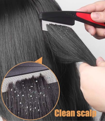 Dandruff Comb Removal Hollow Fine Tooth Scalp Detox Hair Care Tool 2PC | Build Up Flakes Lice Comb, Self Cleaning, Button Release Design, Anti Slip Comb Handle, Scalp Masssage, for Women Men Kids - color: 2PC Black+Red