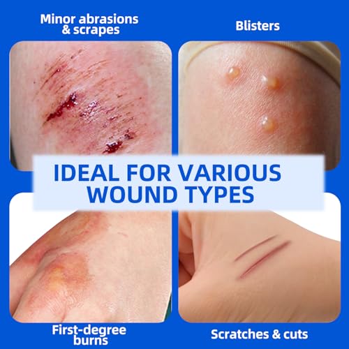 Niceful Hydrocolloid Bandages 4"x4" for Knee, Elbow, 10 Count | Waterproof, Advanced Healing, Extra Thin, Hydrocolloid Dressing Patches, Designed to Fit Joints, for Wounds - size: 4" x 4" (10 Dressings)