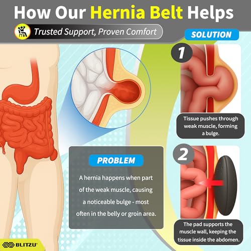 BLITZU Umbilical Hernia Belt for Men Women. Abdominal Binder Support Truss - size: Large-X-Large