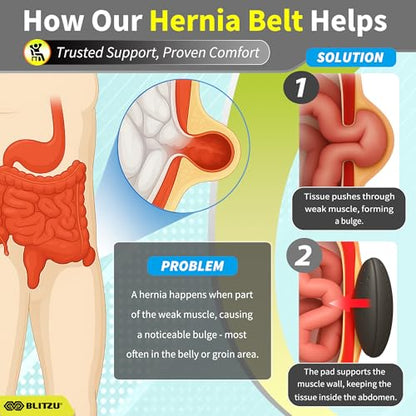 BLITZU Umbilical Hernia Belt for Men Women. Abdominal Binder Support Truss - size: XX-Large