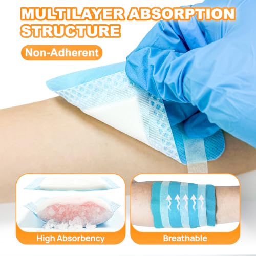 Carbou 4" x 4" Super Absorbent Wound Dressing, 10 Pack, Non-Adhesive Pads - size: 4"x 4"(Pack of 10)