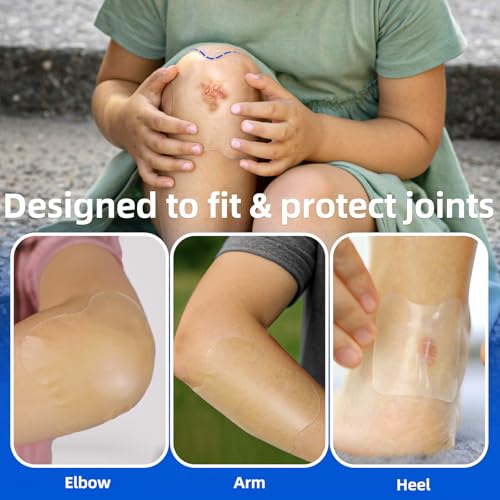 Niceful Hydrocolloid Bandages 4"x4" for Knee, Elbow, 10 Count | Waterproof, Advanced Healing, Extra Thin, Hydrocolloid Dressing Patches, Designed to Fit Joints, for Wounds - size: 4" x 4" (10 Dressings)